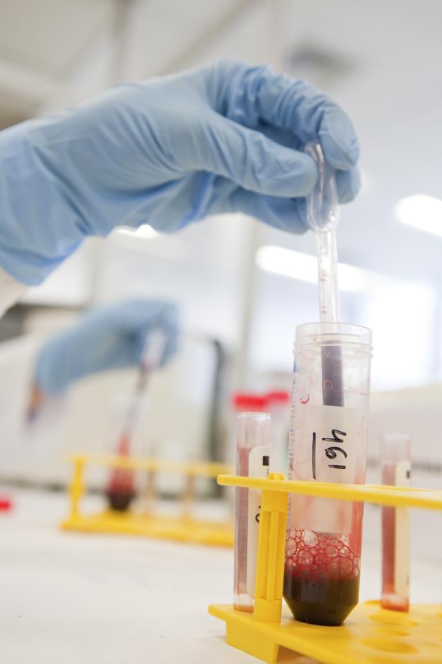 Trasplante de médula ósea