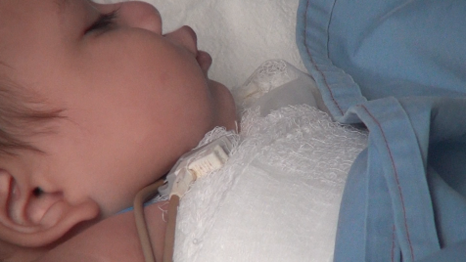 Menos niños quemados por pólvora en temporada de fin de año