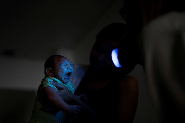 Honduras crea sistema de atención para casos de niños con microcefalia