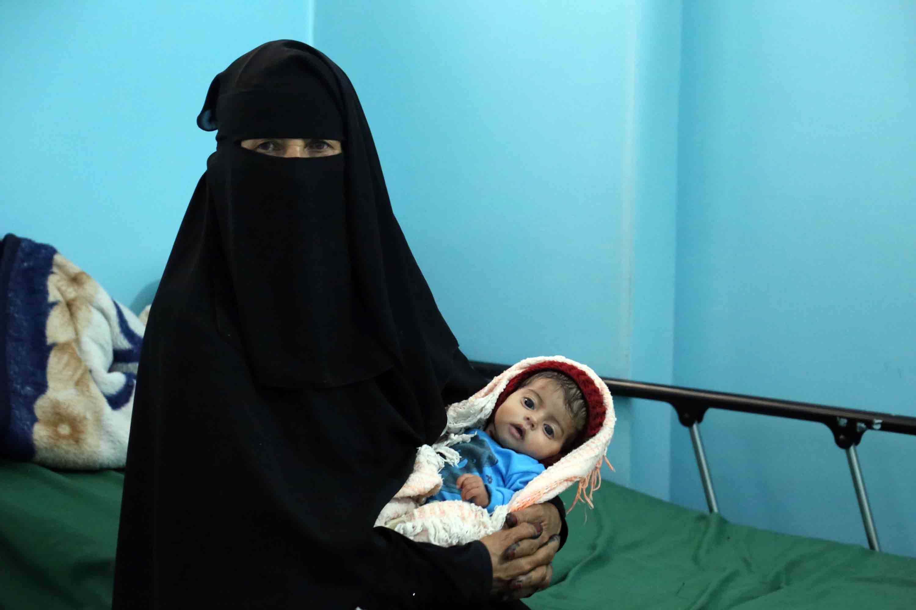 desnutrición, Yemen, Taiz