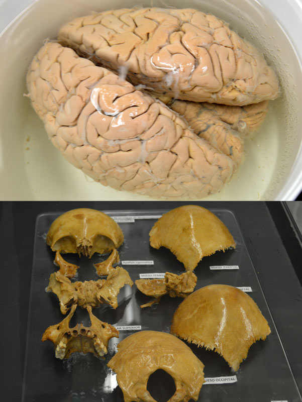Museo de cerebros humanos en Perú muestra colección única en el mundo